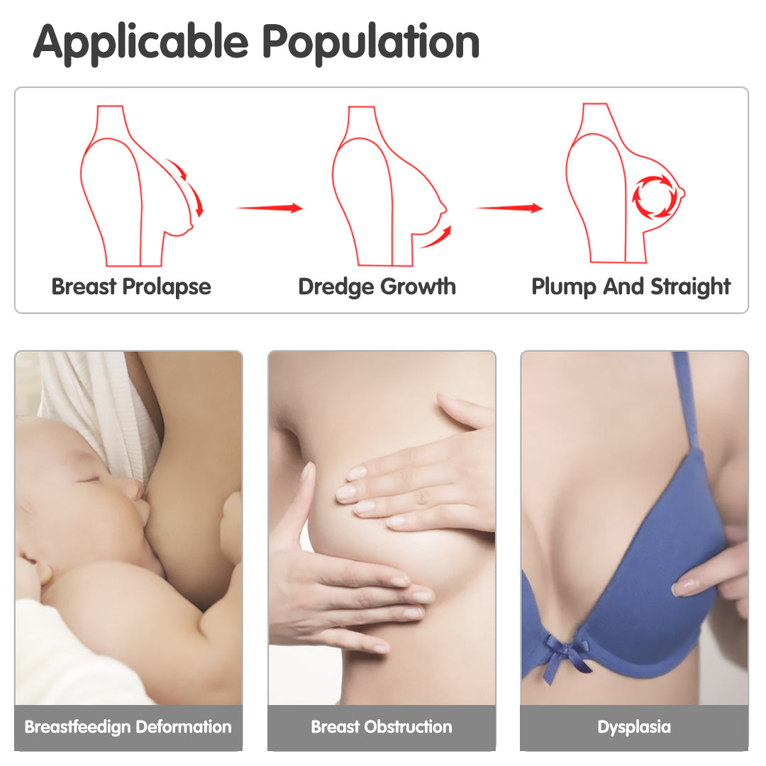 Breast health stages, breast prolapse, dredge growth, plump and straight